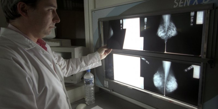 Un radiòleg observa els resultats d'una mamografia.